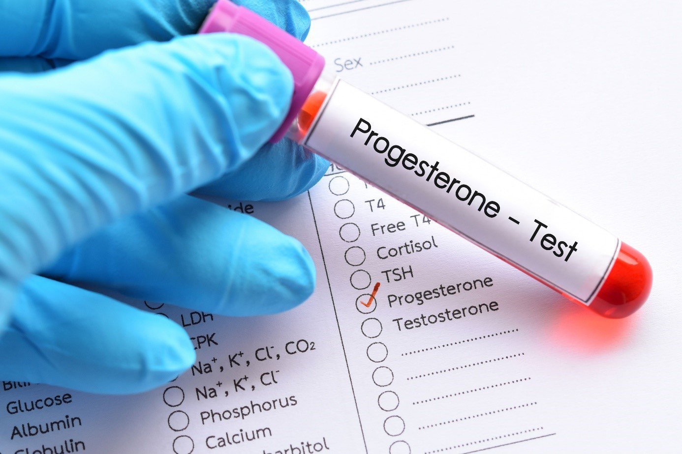 What is Progesterone Testing?